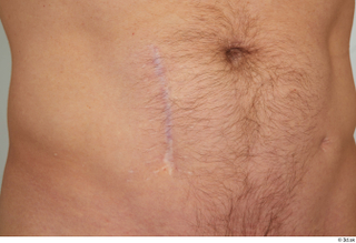  Steve Q belly scar skin 0001.jpg
